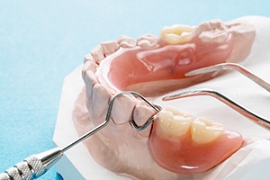 Closeup of partial dentures being made