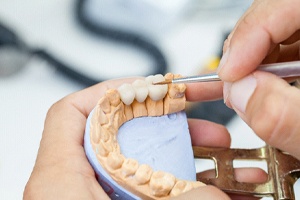 Closeup of dentist in Lewisville crafting a dental bridge