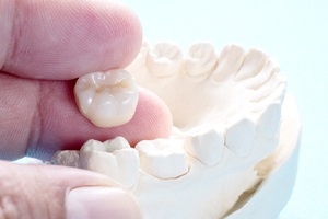 Lewisville dentist holding dental crown above a model jaw