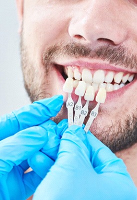 Nose-to-neck view of blue-gloved hands holding shade guide to man’s teeth