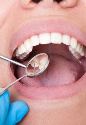 Closeup of woman’s mouth being examined with dental instruments