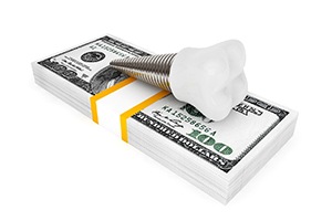 Dental implant in Lewisville on a stack of money