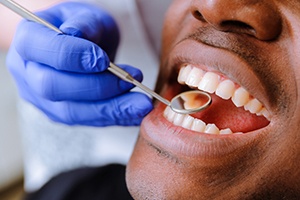 Man getting an oral cancer screening