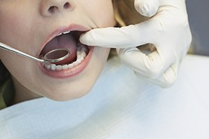 Closeup of teeth being examined by dentist