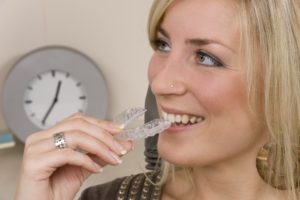 blonde head woman with Invisalign tray