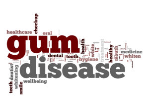 sign that says gum disease