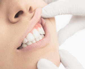 dentist examining woman’s gums