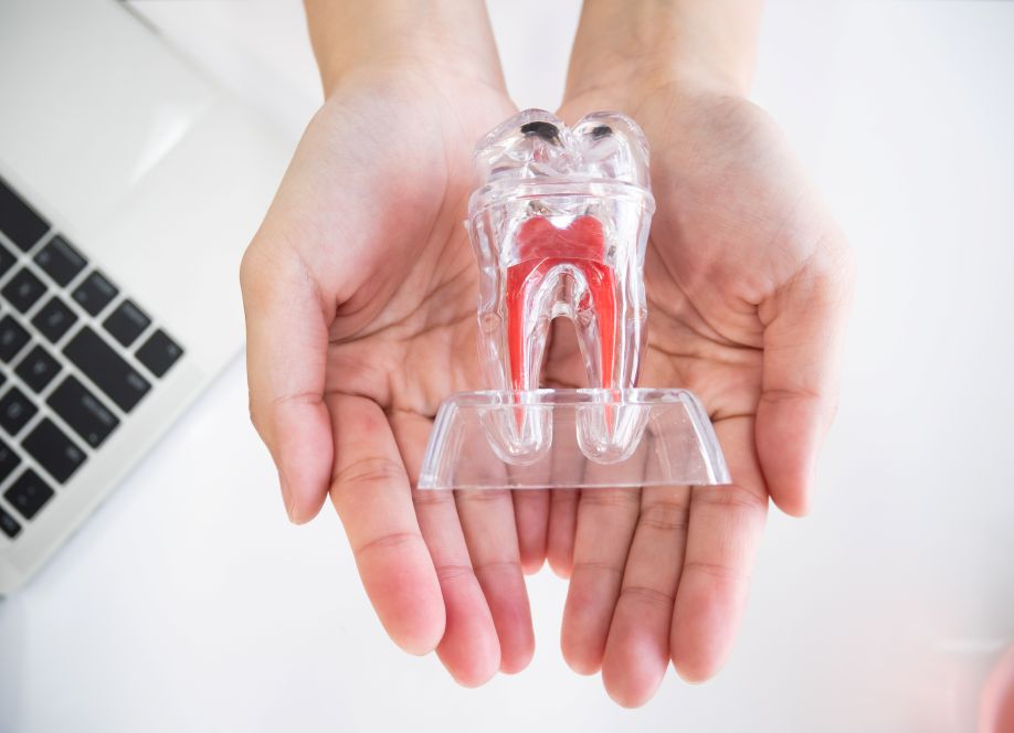 A woman’s hands holding a model of a tooth root system